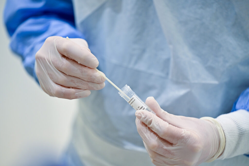 Exceptional things you need to know about rapid antigen tests
